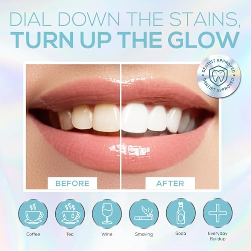 Venus Visage LED Teeth Whitening Kit and Teeth Whitening Gel Syringes Refill (8 Pack, 0.1 fl oz) - Carbamide Peroxide Teeth Whitener Bundle, Low Sensitivity and Enamel-Safe for a Brighter Smile