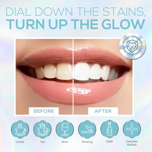 Venus Visage Teeth Whitening Pen (4 Pack) and Teeth Whitening Kit with LED Light Device - Includes 3 Gel Pens, Tooth Whitener Trays & Remineralization Pens, Low Sensitivity & Enamel-Safe, Mint Flavor