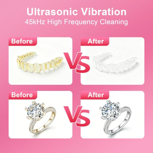 Ultrasonic Retainer Cleaner Machine, 45kHz Ultrasonic Cleaner with UV, Rose