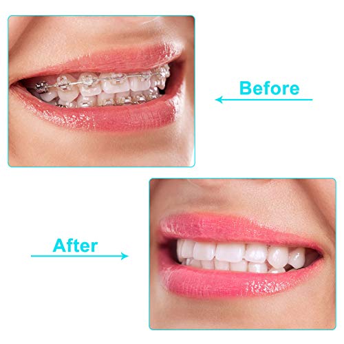 100 Pieces Aligner for Aligner Chompers Aligner Trays Seater Orthodontic Dental Aligner, White Green Orange Pink and Purple