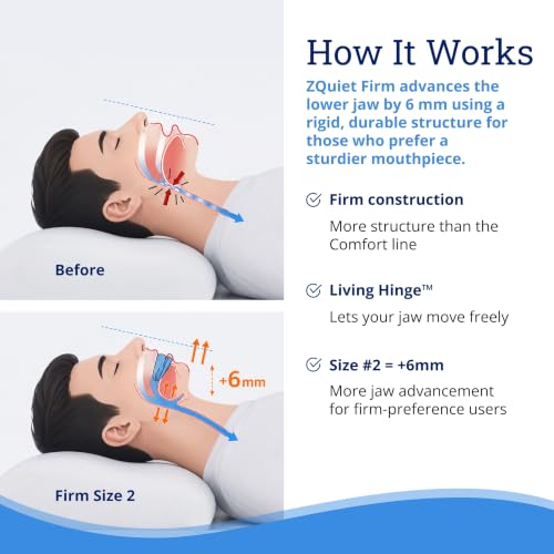 ZQuiet Anti-Snoring Mouthpiece, Firm Anti-Snoring Device, Size 2