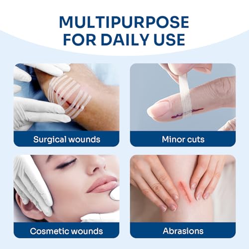 40 Wound Closures, Breathable Strips Hold Small Wounds Firmly Closed