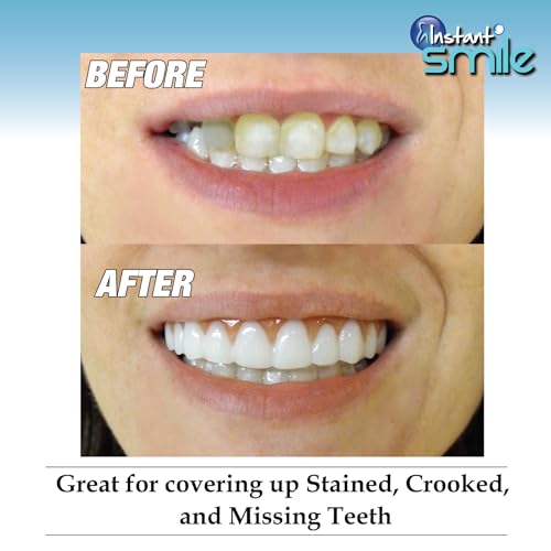 Instant Smile Comfort Fit Flex - Bright Shade - Upper Veneer Cosmetic Teeth