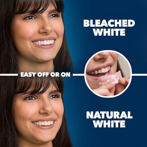 Imako Premium Cosmetic Uppers - 1 Pack - Small, Bleached White - DIY Smile Makeover - Made in USA