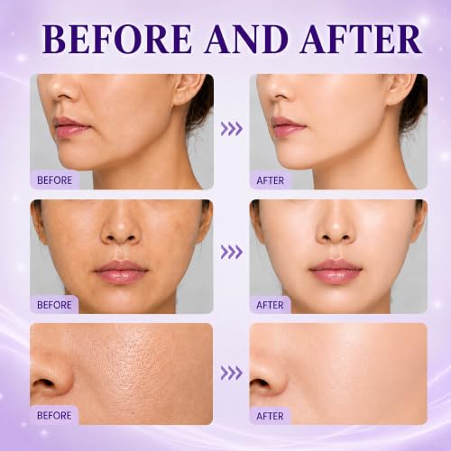 NAD+PDRN Brightening Toner|9+ Brightening Essence Water|Multi-Peptide Firming|Hydrating & Barrier Repair Toner|for All Skin Types|5.07FL OZ 1PCS 1 Pcs 5.07 Fl Oz (Pack of 1)