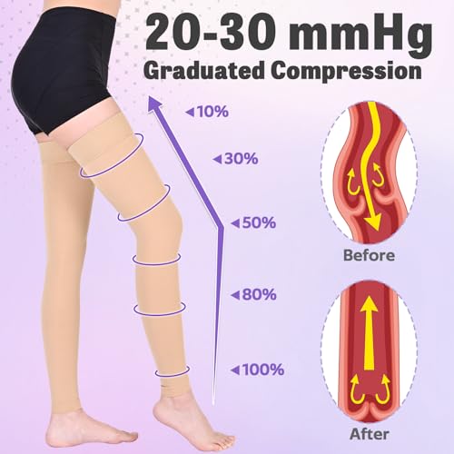 Ktinnead 20-30mmHg Thigh High Compression Socks for Women Men, Footless Beige X-Large
