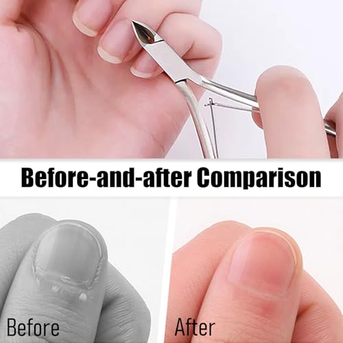 Bestac Professional Stainless Steel Cuticle Trimmer - Extremely Sharp Dead Skin Clipper Nippers, Labor-Saving Cuticula Remover for Fingernails Toenails, Manicure Pedicure Tools for Women Men