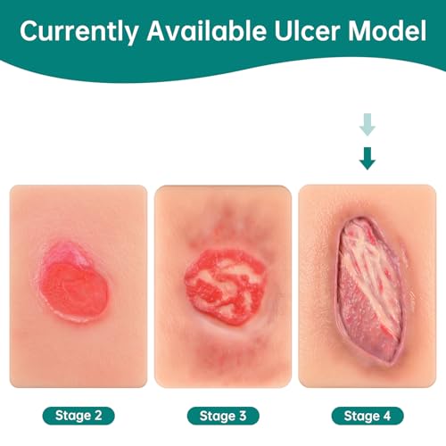 Pressure Ulcer Wound Model Stage 4 Pocket Size
