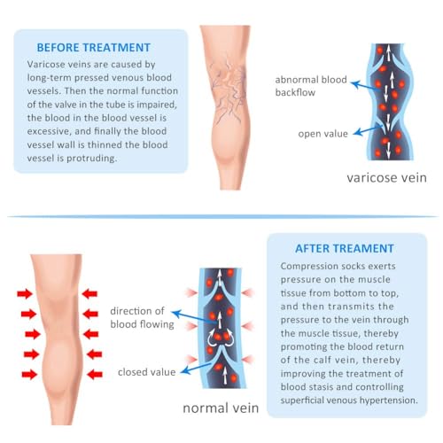 20-30mmHg Compression Pantyhose for Women, Medical Compression Stockings, High Waist Opaque Compression Tights for Lymphadema Edema, Swelling, Varicose Veins, Support Hose for Teacher Doctor L Black