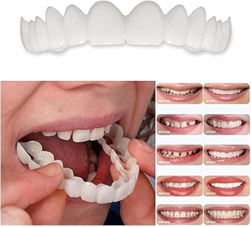 2 Pairs Secure Fit Smile Improvement, Upgraded Contact Surface, Soft Reusable Adjustable Daily Wearing Set for Long Social Events(7.0) 7.0