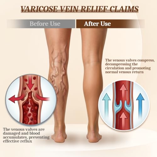 Medical Compression Stockings for Women 20-30mmHg Compression Leggings Black X-Large