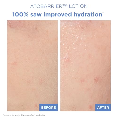 AESTURA ATOBARRIER365 Lightweight Korean Face Moisturizer with Ceramides | Strengthens Barrier, Fast-Absorbing Hydration, Suitable for Dry, Normal & Sensitive Skin, 150ML / 5.07 fl. Oz. 5.07 Fl Oz (Pack of 1)