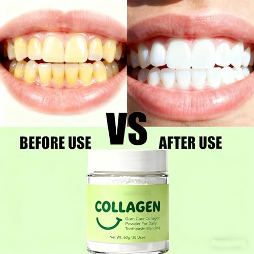 Collagen Powder for Gums - Collagen Tooth Powder for Gums - Hydroxyapatite Toothpaste Care Powder Protect Gum - Mineral-Infused-Collagen Formula 60g (1) 1