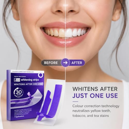 Purple Teeth Whitening Strips | Instant Color Correction & Smile Bright 2PCS