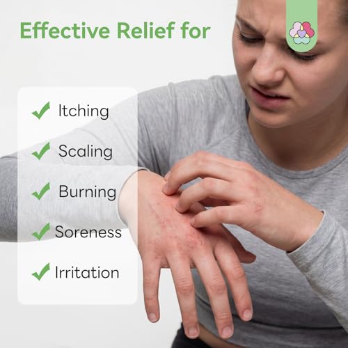 SAVILAND Antifungal Cream Athlete's Foot Jock Itch Ringworm Treatment 4.2oz
