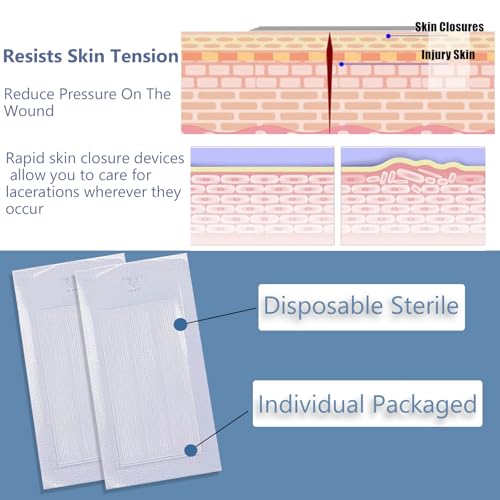 Skin Wound Closures Strips - 30 Pcs Emergency Wound Stitch Tapes, Adhesive Bandages for Closing Small Cuts, Sterile Individual Packaging