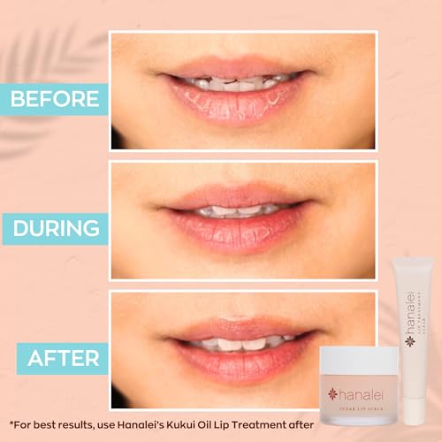 Hanalei Vegan Sugar Lip Scrub Exfoliator (22g) + Lip Balm Variety Pack (5 Tubes) – Hydrating Lip Care with Kukui Oil, Shea Butter & Beeswax – Smooth, Nourish & Protect Lips