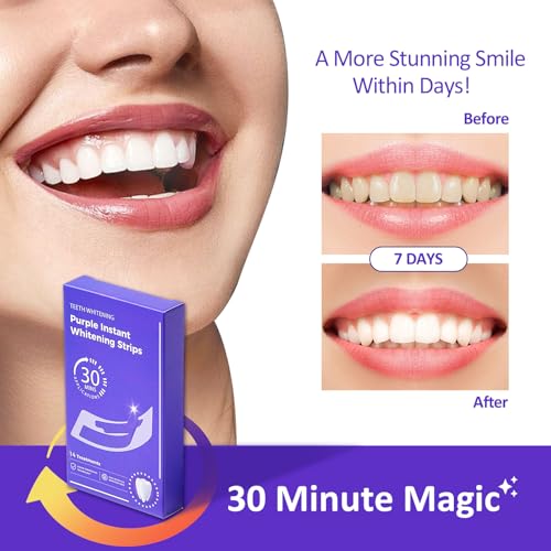Teeth Whitening Strips kit - Enamel Safe for Whiter Teeth - Whitening Without Sensitivity - Fast Acting for Removing Stains from Coffee, Wine and Smoking (14 Strips, Mint)