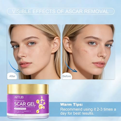 Scar Cream,Silicone Scar Gel,Helps Reduce Surgical Scars,Acne,Burn,Keloids Bump,Stretch Marks, Advanced Scar Removal Cream for Old and New Scars(1.69oz) 1.69 Ounce