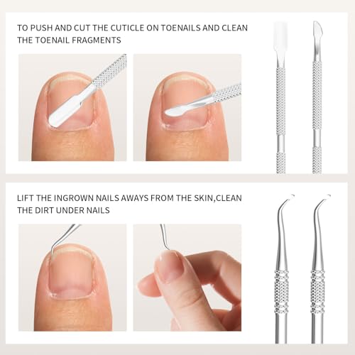 ZIZZON 7 Pcs Ingrown Toenail File and Lifters Set, Stainless Steel Ingrown Toenail Removal Kit, Under Nail Cleaner Pedicure Tools 7pcs
