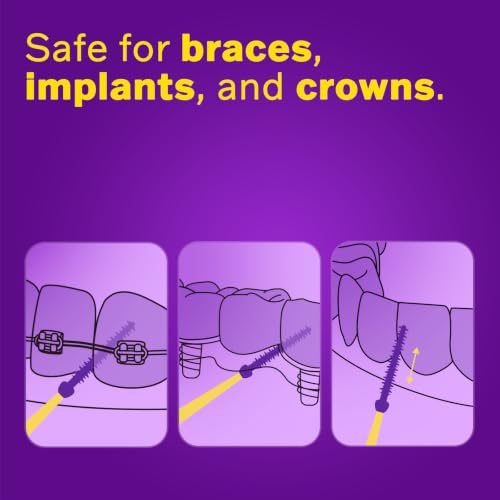 Soft Flexible Interdental Picks, Wire-Free, Sensitive Gums, 320 Ct