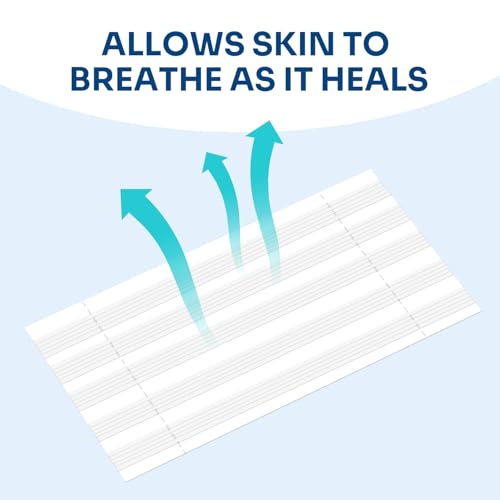 40 Wound Closures, Breathable Strips Hold Small Wounds Firmly Closed