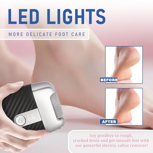 Electric Foot File with 2 Speeds & LED Display, Rechargeable Callus Remover with 3 Grit Heads (Coarse/Medium/Fine), Pedicure Tools for Feet Hard Skin Smooth Polishing (Black)