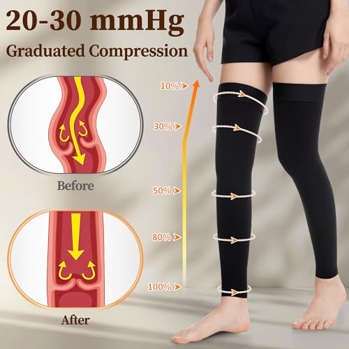 Medical Compression Stockings, 20-30 mmHg Thigh High Support Socks X-Large Black