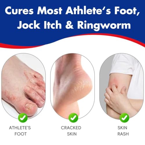 Clotrimazole Antifungal Cream 1% USP (1 oz), Anti Fungal Treatment, Relieves Itching, Burning, Cracking and Scaling Associated Athletes Foot 1 BOX