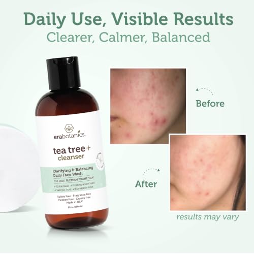 Era Organics Tea Tree Oil Face Wash - Salicylic Acid Cleanser for Oily Skin