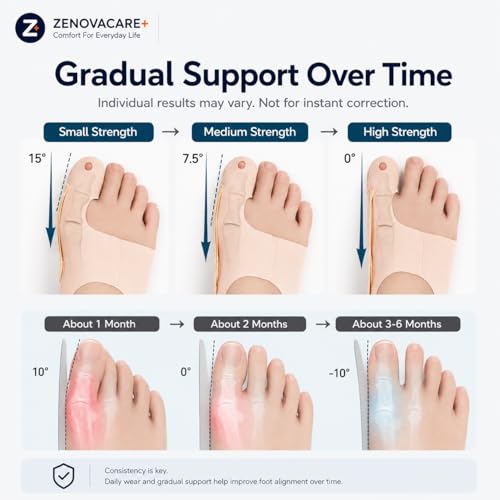24-Hour Bunion Corrector Set – Day & Night Toe Alignment System, Soft Walking Sleeve + Night Splint for Sleeping, Big Toe Pain Relief & Gradual Support for Men & Women 2 Pairs(L) L