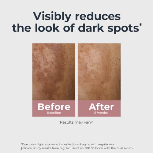 Eucerin Radiant Tone Dual Serum Dark Spot Corrector, Dark Spot Serum with Thiamidol and Hyaluronic Acid, 1 Fl Oz Bottle 1 Fl Oz (Pack of 1)