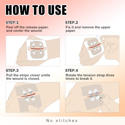Carbou 4 Pcs Zip Sutures Wound Closure Device + 10 Pcs Silicone Foam Dressing with Gentle Border 4"x4"