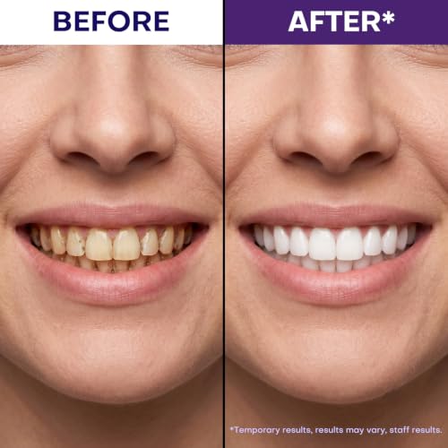Teeth Whitening Strips, Teeth Whitening Kit for Brighter Smile, Enamel Safe Tooth Whitening Strips, Purple Teeth Whitening Strips Alternative for Daily Teeth Whitening, 28 Whitening Strips