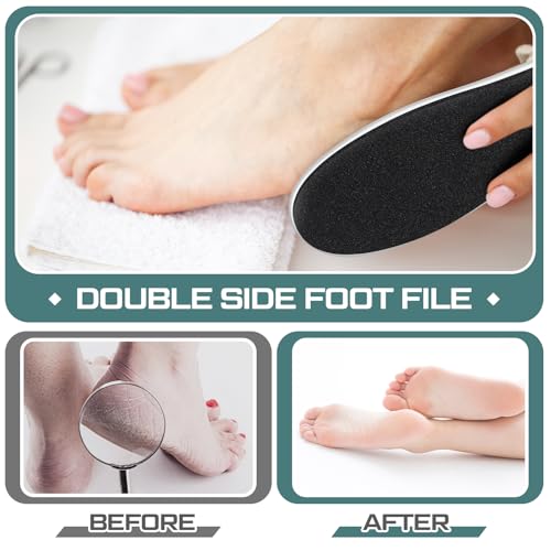Lothee 15 Pack Foot File Foot Callus Remover Double Sided Professional Sandpaper Pedicure Tool Feet Scrubber Sander Feet Rasp for Dead Skin Cracked Heel Women Manicure Beauty Spa, 100/180 Grit, White