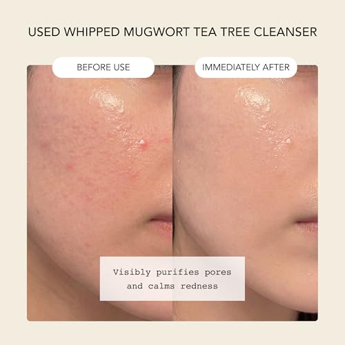 Whipped Korean Skincare Face Wash, Doubles as a Face Mask, Mugwort Tea Tree, Deep Cleansing Vegan Facial Cleanser for Oily Skin and Pore Care with Matcha, Centella Asiatica, Niacinamide