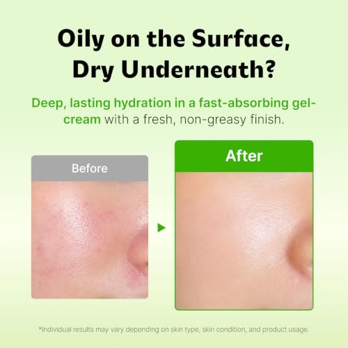 ISOI Moisture Dr. Soothing Cream, Face & Neck Moisturizer, 2.37 fl oz