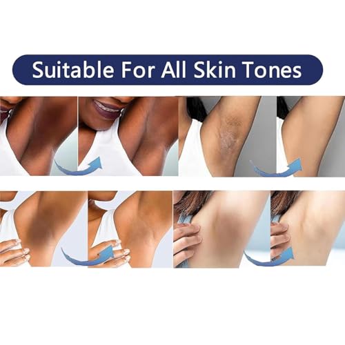 Skin Bleaching Cream Skin Lightening for Body Intimate Areas, Private Parts, Underarm, Knees, Elbows, Inner Thigh, Bikini Area, Whitening Cream Dark Spot Remover For Intimate Areas (1FL OZ) 1 Fl Oz
