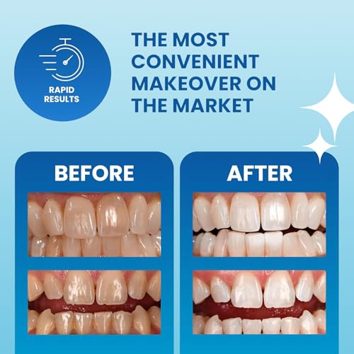 POOOF! Dissolving Teeth Whitening Strips by Dr. Bill Dorfman,12% Hydrogen Peroxide Professional White Strips, Enamel-Safe, Zero Sensitivity Formula, Dentist-Developed Mint Whitener | 10-Day, 20 Strips