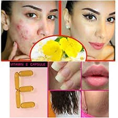 50 Evion Capsules Vitamin E For Glowing Face,Strong Hair,Acne,Nails, Glowing Skin 400mg - BeesActive Australia
