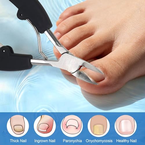 Ingrown Toenail Clippers, Professional Stainless Steel Toe Nail Clippers