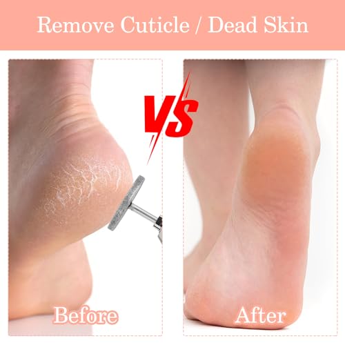 Andibro 2Pcs Sanding Disc Nail Drill Bits,Electric Foot File Hard Skin Remover Discs Emery Carbide Callus Remover Pads Pedicure Sandpapers Replacement Cracked Skin Callus Removal for Manicure Pedicure