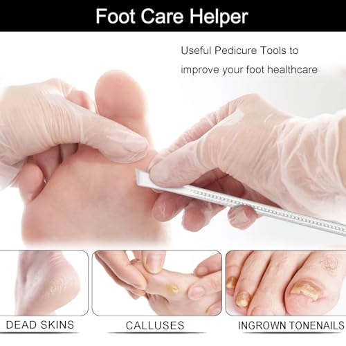 Segbeauty 2pcs Stainless Steel Ingrown Toenail Removal Kit with 1000 Grit Whetstone, Professional Pedicure Tools for Feet, Foot Scraper for Dead Skin Removal, At Home Foot Care Cuticle Remover Kit Scraper + Inclined Knife