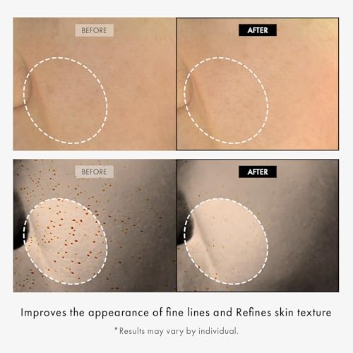 TOSOWOONG Copper Peptide 12 Cream, Anti-Aging for Fine Lines, Wrinkles