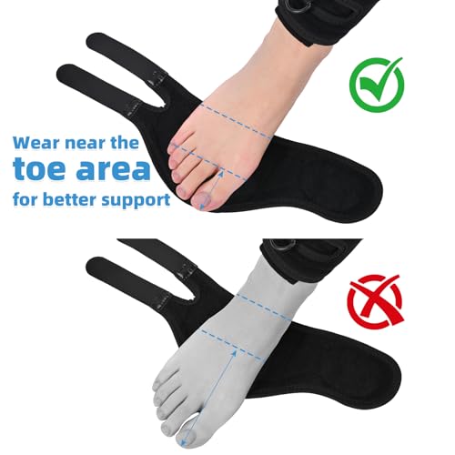 Tenbon Adjustable AFO Foot Drop Brace for Walking with Shoes, Socks, Or Barefoot Dorsiflexion Assist, Day & Night Use, Fits Left or Right Foot (Unisex, All-Day Wearable) S Day+Night (1 PACK)