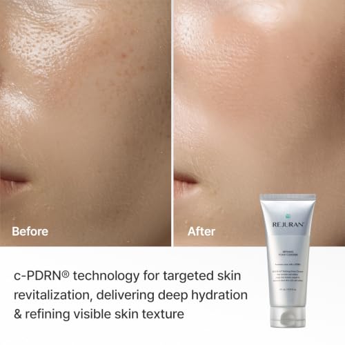 REJURAN Refining Foam Cleanser, c-PDRN® Facial Cleanser, 4.05 fl oz