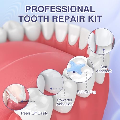 Zinc Oxide Eugenol Dental Cement Tooth Repair Kit for Broken Teeth, Temporary Filling for Crowns, Tooth Filler, Cavity Filler (Natural White) Natural White