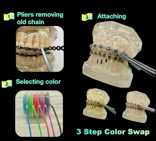 Dental Braces Color Changing Kit, 5 Rolls Continuous Braces Power Chains Orthodontic Pliers Changing kit, Change The Color of Your Braces Yourself in Minutes Ligas para Brackets Ortodoncia