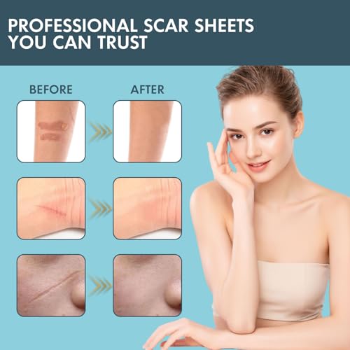 Silicone Scar Sheets, Silicone Scar Tape for Scar Removal Treatment (1.6”x 60” Roll-1.5M), Reusable Silicone Scar Strips for Surgical, C-Section, Tummy Tuck, Keloid Scars, Burn, Acne