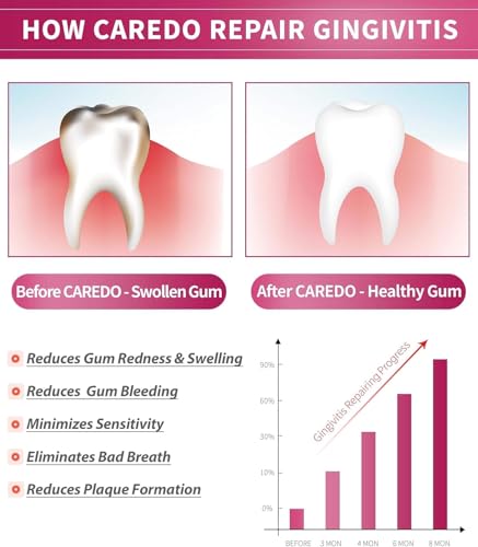 CAREDO Gingivitis Toothpaste Gum Repair for Bleeding Gums, Swollen Gums Treatment for Gum Sensitivity, Gingivitis Treatment for Gum Disease, Reverse Gingivitis Treatment for Adults Oral Care, 3.52OZ